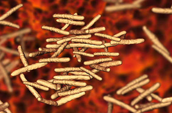 Infections à mycobactéries non tuberculeuses : de nouvelles recommandations