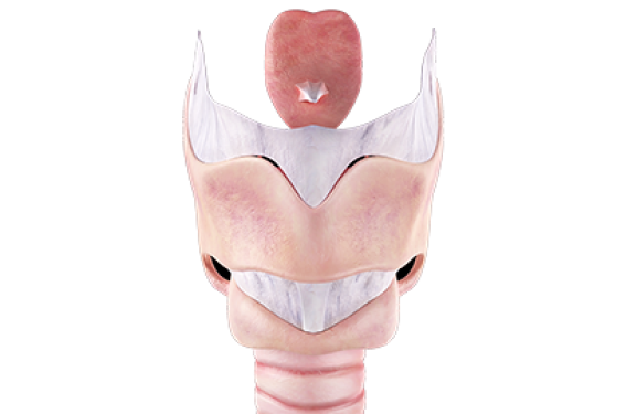La laryngomalacie du nourrisson
